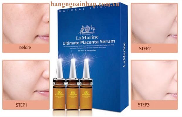 Huyết thanh nhau thai cừu của Úc La Marine Ultimate Placenta Serum Lalisse